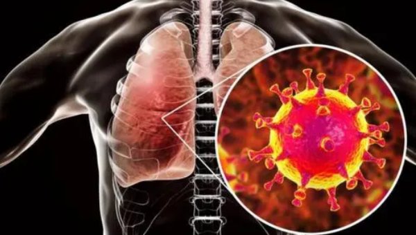 国家卫健委印发新型冠状病毒肺炎诊疗方案(试行第六版)